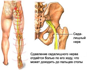 Лечение болей в тазобедренных суставах в клинике Артус в Казани